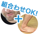 2ヵ所以上のモニターもできます