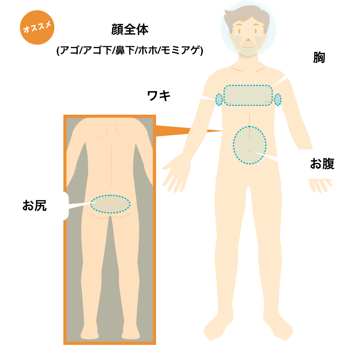 顔全体(アゴ・アゴ下・鼻下・ホホ・モミアゲ)、胸、お腹、ワキ、お尻からお好きな1箇所!