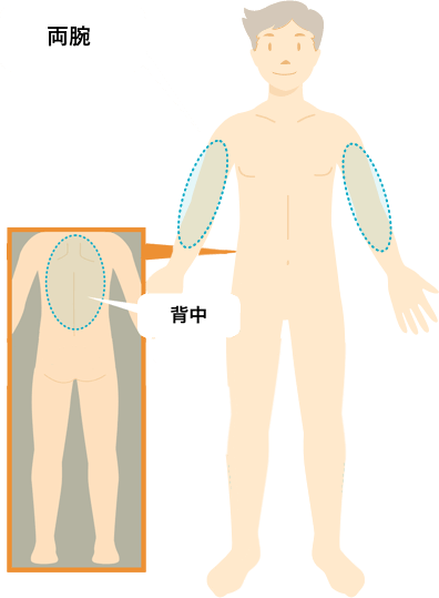 両方の腕(肘周り、手、指まで対象)、背中からお好きな1箇所!