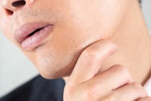 髭は体と比べて脱毛でツルツルにするには時間が掛かる。