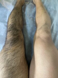 横浜のメンズ脱毛/完全都度払いで安い男性専用脱毛サロン