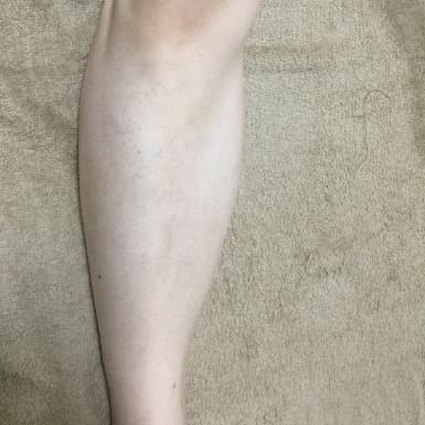横浜のメンズ脱毛/完全都度払いで安い男性専用脱毛サロン