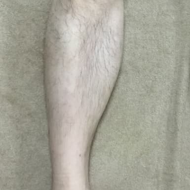 横浜のメンズ脱毛/完全都度払いで安い男性専用脱毛サロン