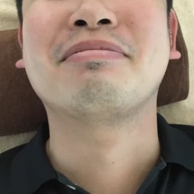 横浜のメンズ脱毛/完全都度払いで安い男性専用脱毛サロン