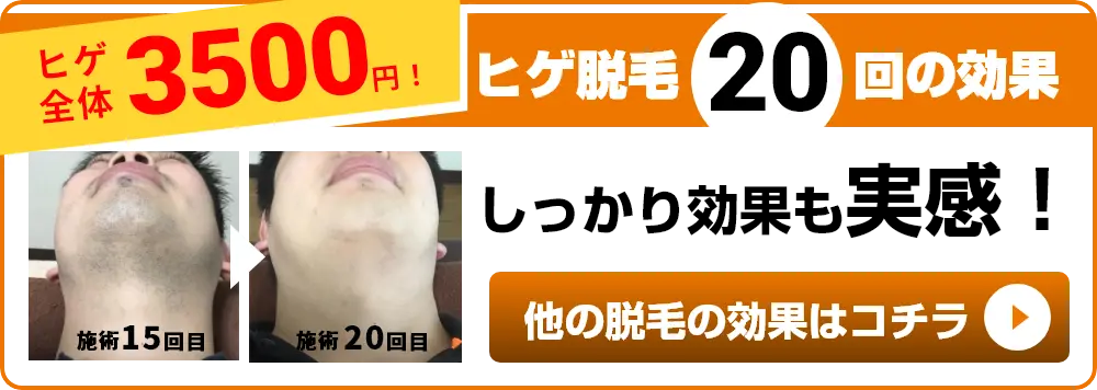 ヒゲ全体3500円