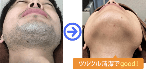 ツルツル清潔でgood！